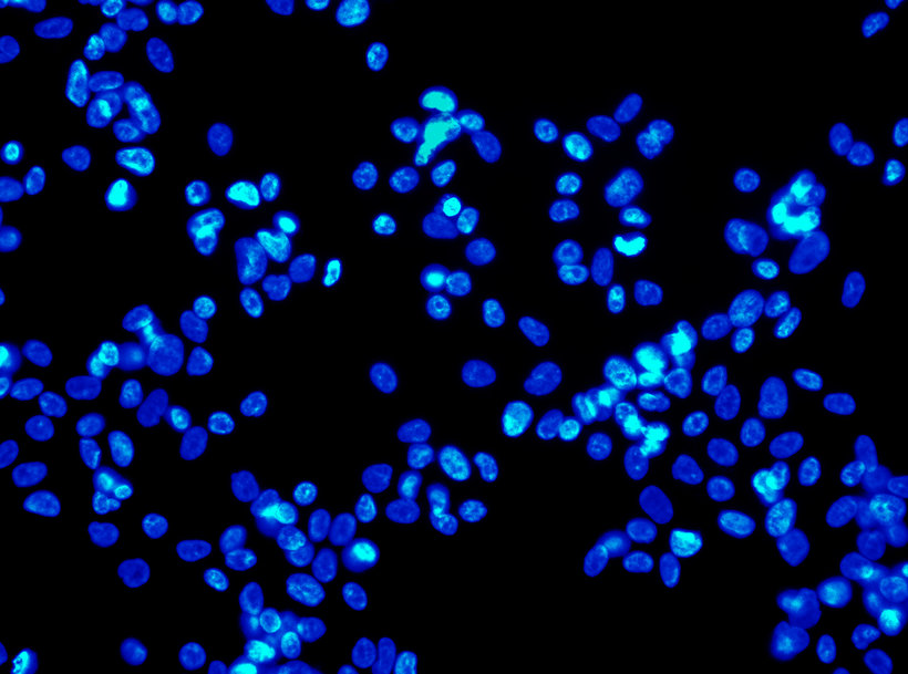 Imagerie biomédicale : Guide sur le choix des caractéristiques des caméras de vision artificielle et sur leur mode de calcul